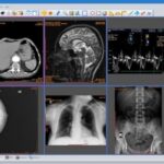 DICOM