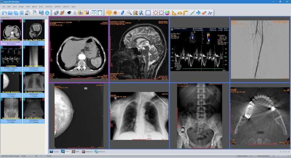 DICOM Editor
