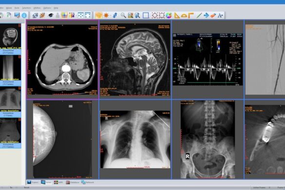 DICOM Editor