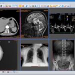 DICOM Editor