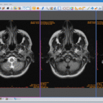 DICOM Viewer