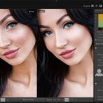 SkinFiner
