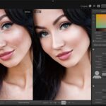 SkinFiner